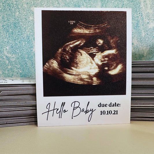 Custom Photo Magnet with an Ultrasound Image of a Baby with 'Hello Baby' and Due Date text.