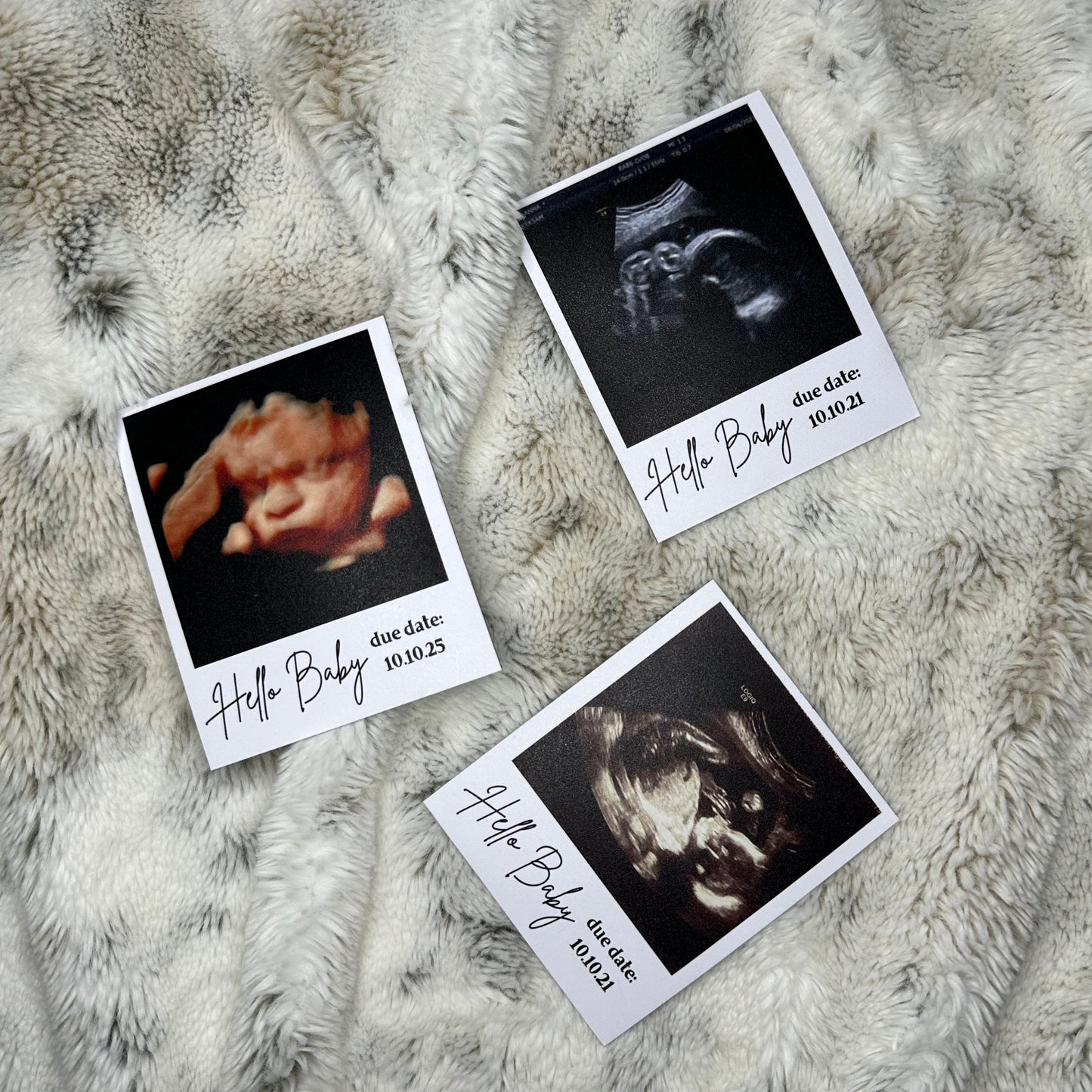 Three custom ultrasound photo magnets on a textured surface with 'Hello Baby' text.